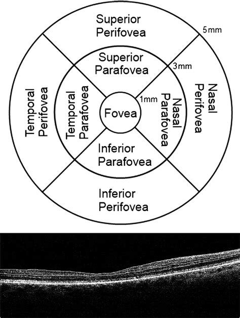 retinal thickness measurements